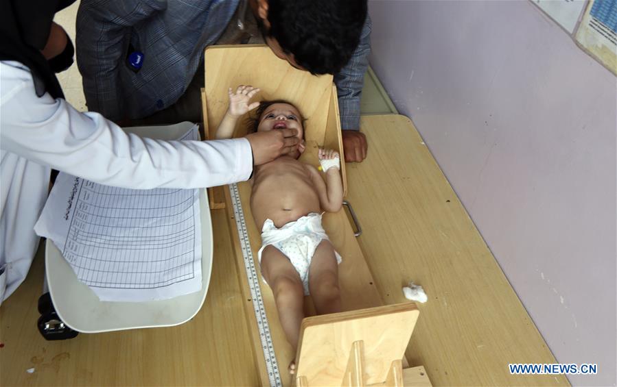 YEMEN-SANAA-CHILDREN-MALNUTRITION