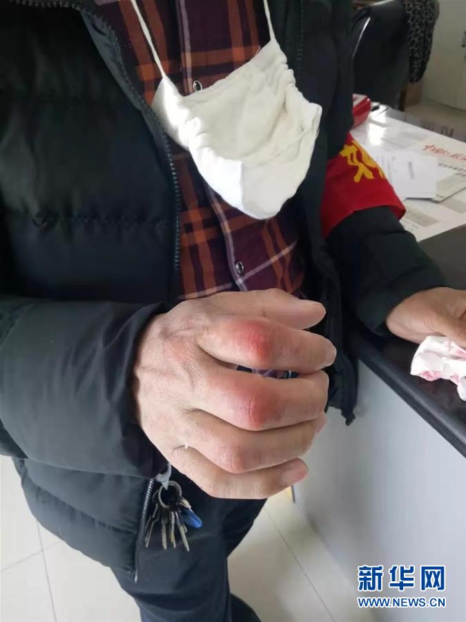 (在習近平新時代中國特色社會主義思想指引下——新時代新作為新篇章·習近平總書記關(guān)切事·圖文互動)(2)戰(zhàn)“疫”中的“凡人微光”